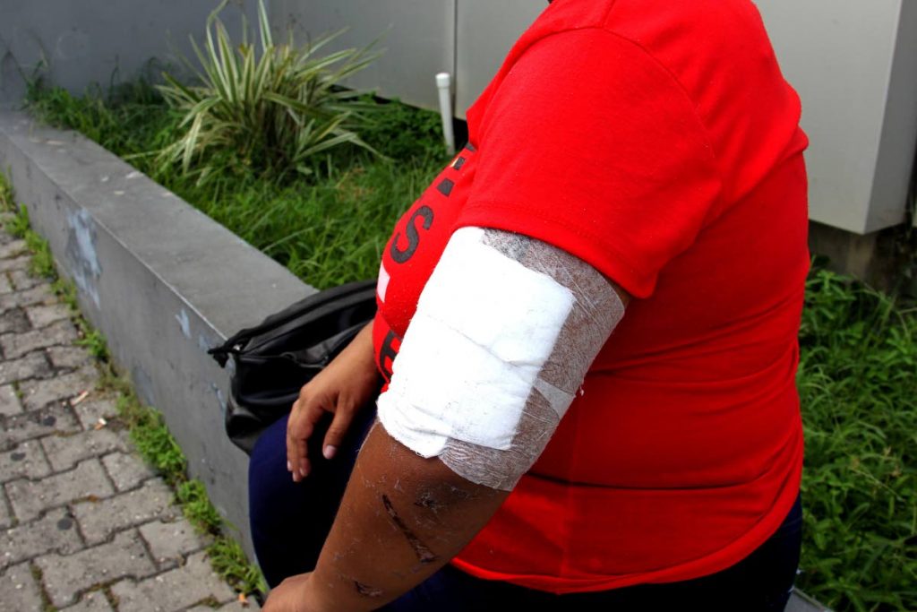 Bandaged up: Stabbing victim shows her bandaged arm, 
even as her 12-year-old daughter remains at hospital 
recovering from similar wounds.