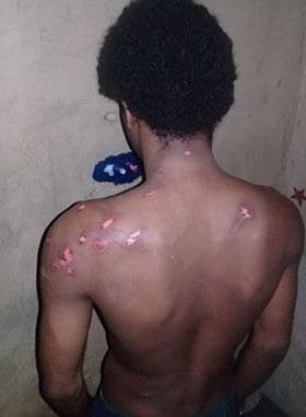 This photo was sent to Newsday by someone purporting to be an inmate at the Port of Spain prison showing injuries he sustained during a lockdown and search of the facility one week ago.