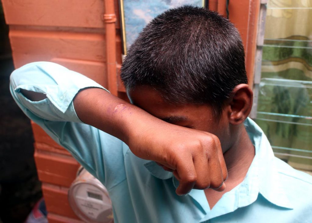 RESCUED:This 14 year old boy was rescued by
officers of the Children⁳ Authority after social media posts revealed him being abused by family members who slashed him across the wrist. PHOTO BY ANSEL JEBODH