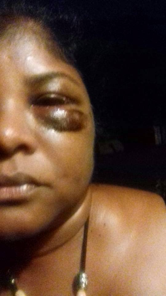 APPEAL: One of the photos posted on Facebook by Gail Harripersad to bring attention to her plight of being abused by 
a male relative.