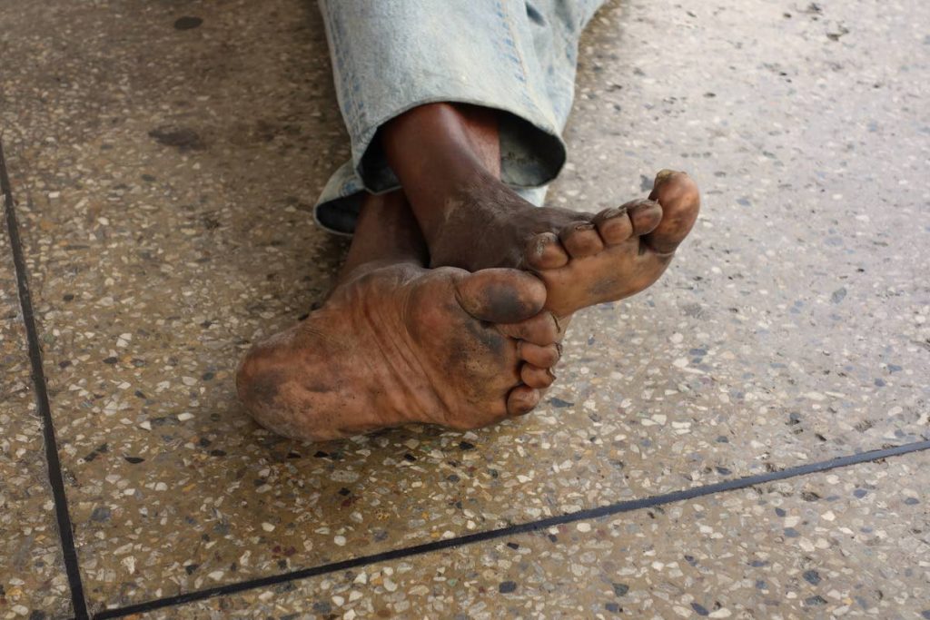 Louis Lee Singh's Dirty Feet, from the State of Neglect collection.

