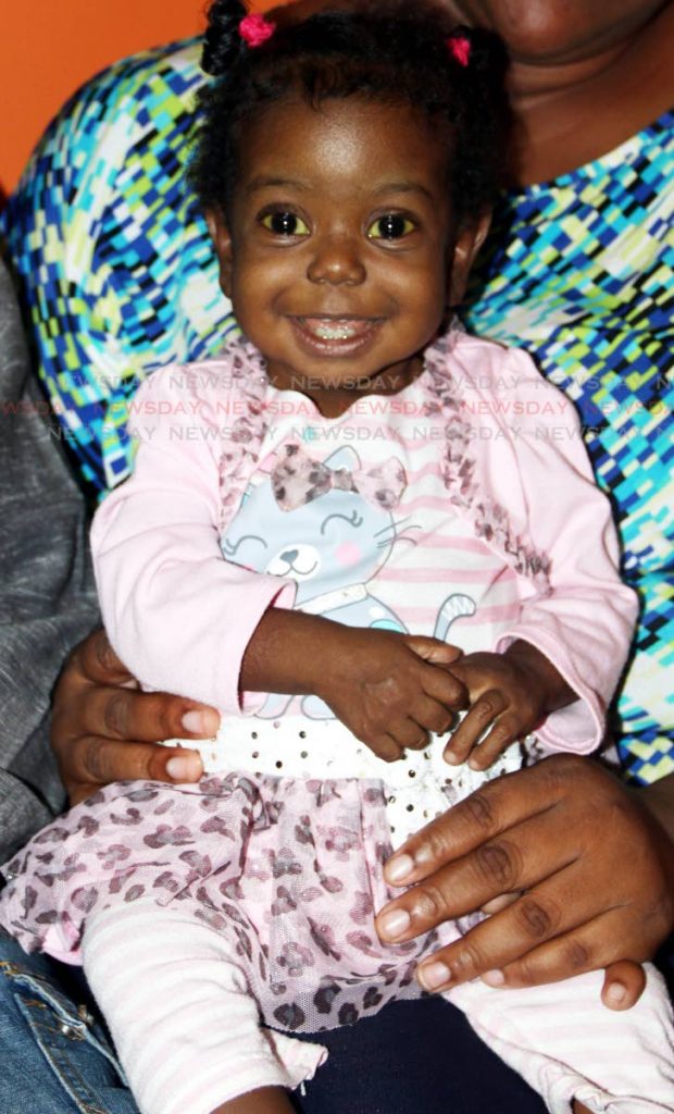 HOPE: Sheenece Jackson, who at 18 months, is in need of potentially life-saving liver transplant surgery.