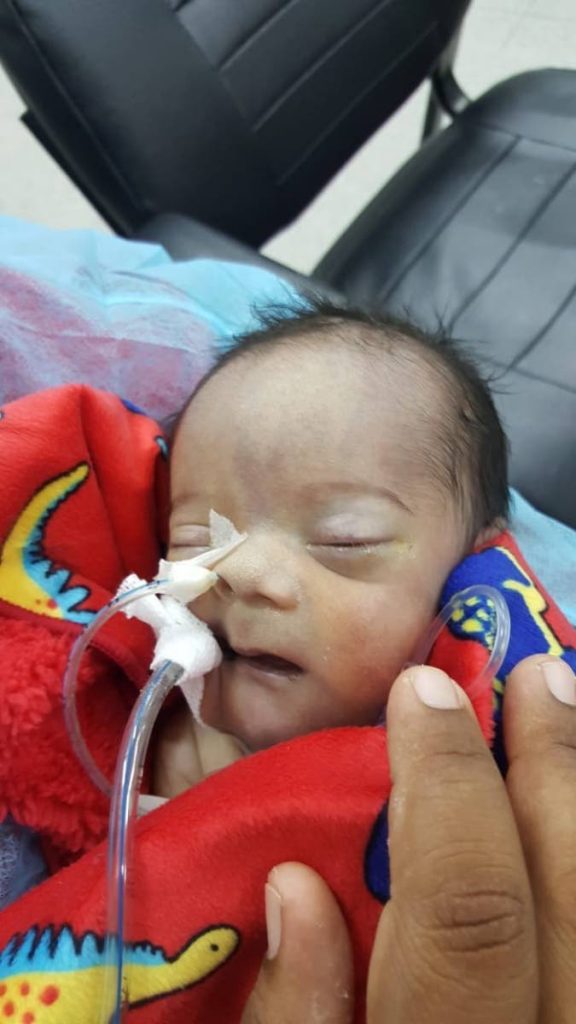 Baby Jeremy Bernard had to breathe through tubes before his death on September 22.
