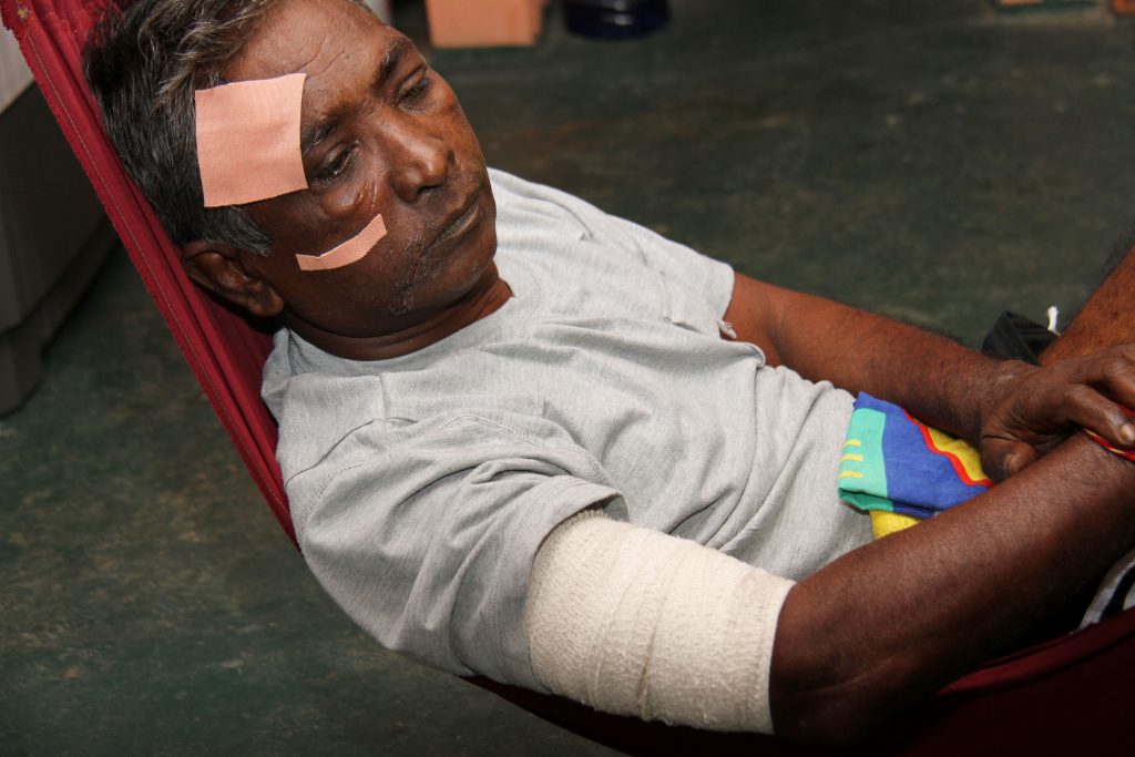 Just left with a vivid memory of what happened on the Solomon Hochoy Highway, last Tuesday, Khemraj Ramgohan, 62, of Rousillac, is left with blurred vision to the left eye, along with sharp pains to his back an legs causing diffculty to walk, alongside other injuries to his face, and arms.



PHOTO BY: CHEQUANA WHEELER