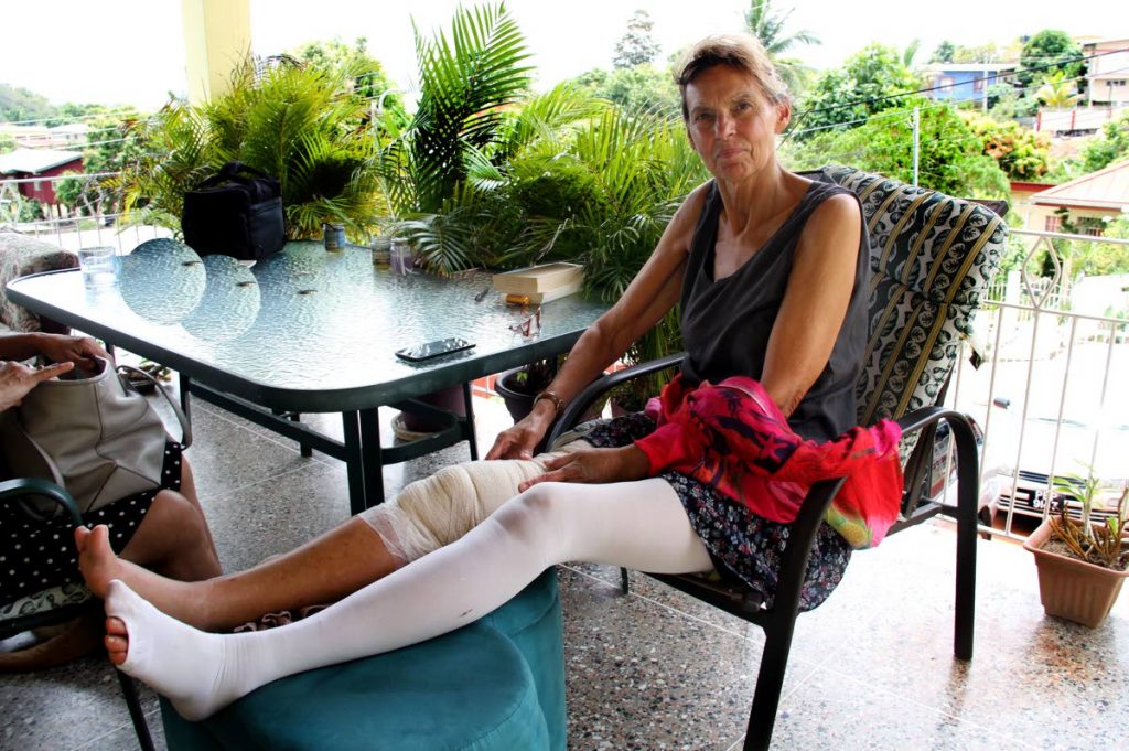 RECOVERING: German tourist Ulrike Frenking at her son’s apartment home in St Joseph yesterday, a week after she broke her leg during a fall in a bat cave in Mt Tamana. PHOTO BY SUREASH CHOLAI