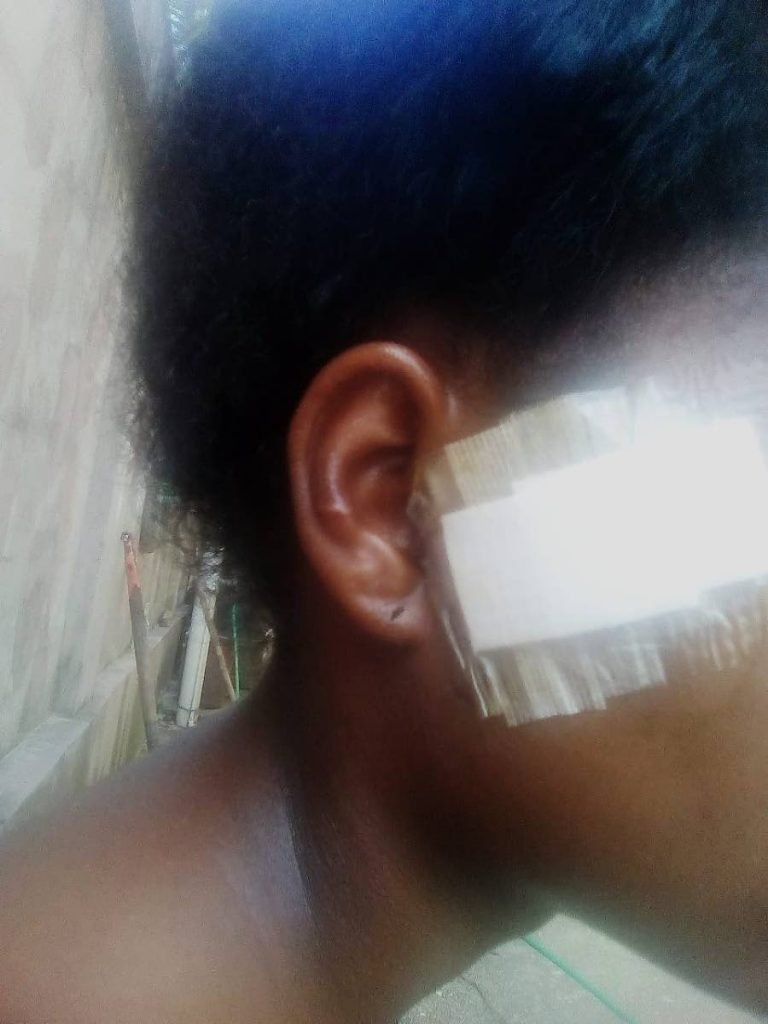 A 15-year-old student of Guayaguayare Secondary School recovers in hospital with a bandage over the slash on her face inflicted by her female schoolmates.
 - 