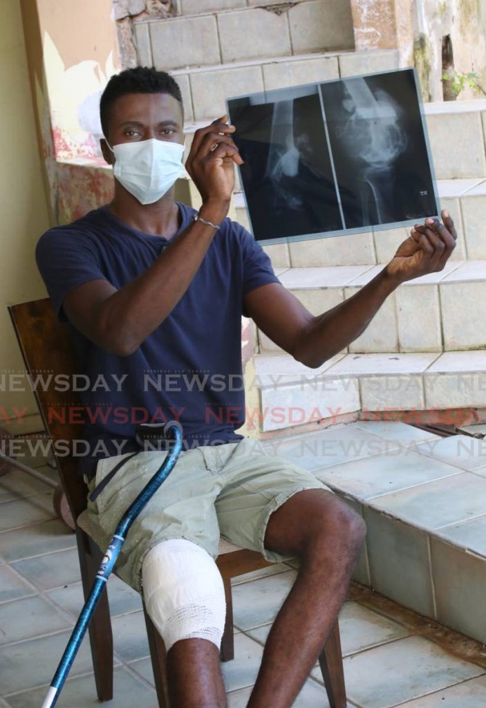 File photo: Vivian Williams shows x-rays of his knee at his home in Cascade. Photo by Sureash Cholai