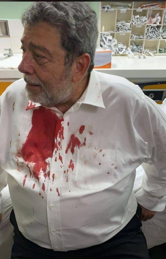 St Vincent and the Grenadines PM Dr Ralph Gonsalves at hospital after being hit with an object outside the Parliament during a protest. - 