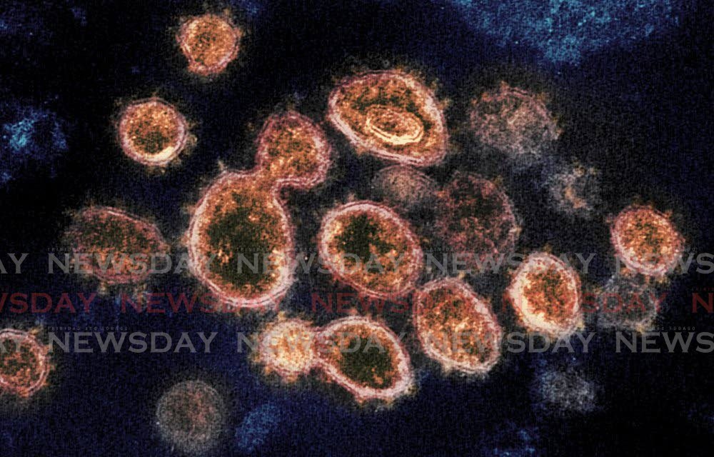 This electron microscope image shows SARS-CoV-2 virus particles which cause covid19, isolated from a patient in the US, emerging from the surface of cells cultured in a lab. AP PHOTO - 