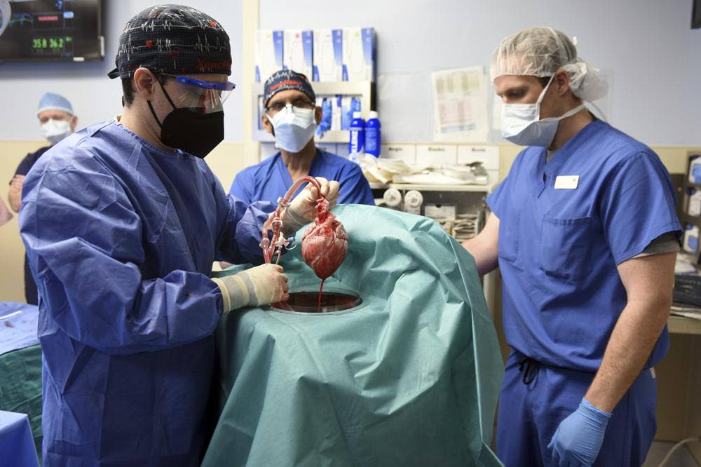 Surgical team members show the pig heart for transplant into the patient in Baltimore. University of Maryland School of Medicine via AP - 