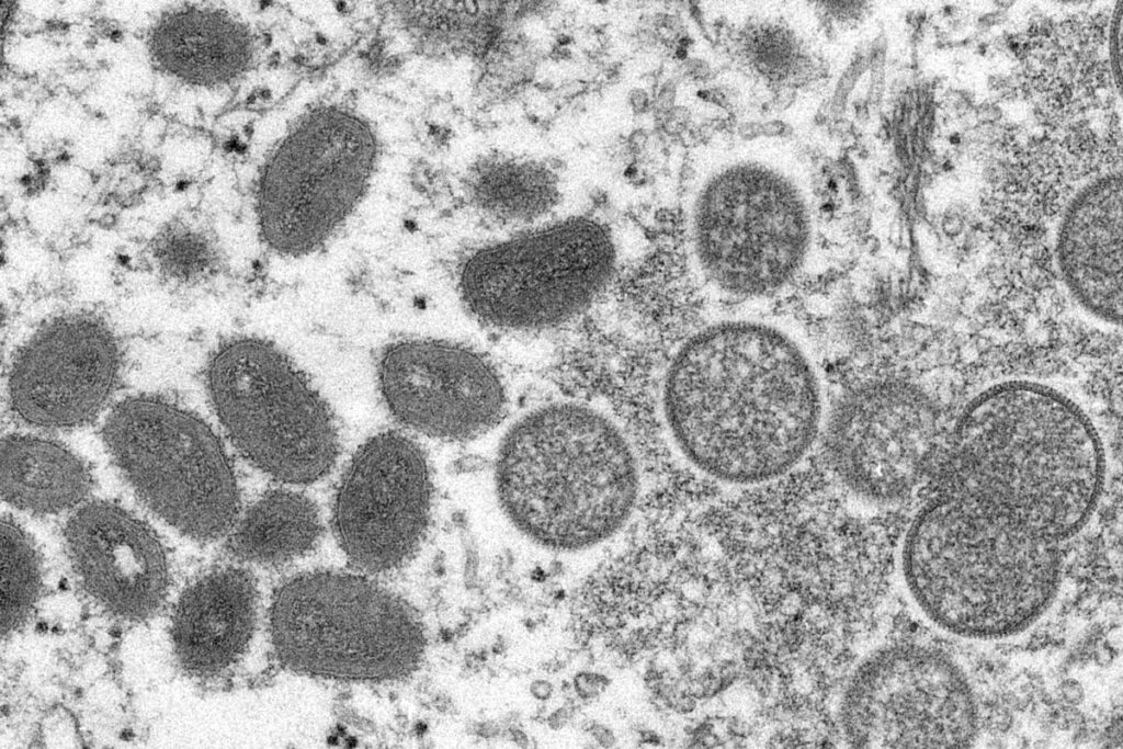 FILE - This 2003 electron microscope image made available by the Centers for Disease Control and Prevention shows mature, oval-shaped monkeypox virions, left, and spherical immature virions, right, obtained from a sample of human skin. - 