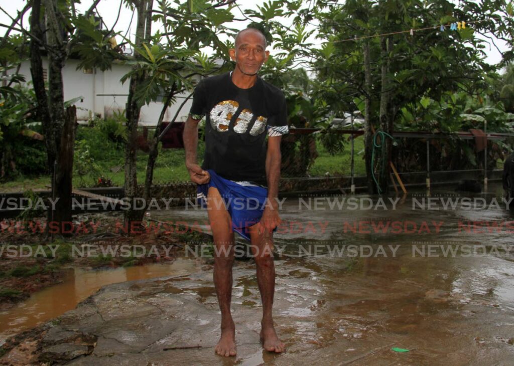 Derick Pollard shows the bruises he got after being swept away by floodwaters before being rescued by his nephew on the Arima Old Road, Arouca on Wednesday. Photo by Ayanna Kinsale
