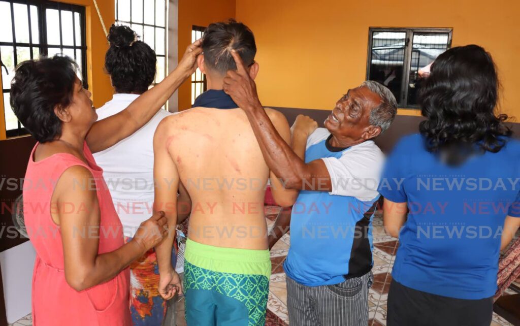 Family members show off the injuries to the head and back of one of their loved ones.  - ROGER JACOB