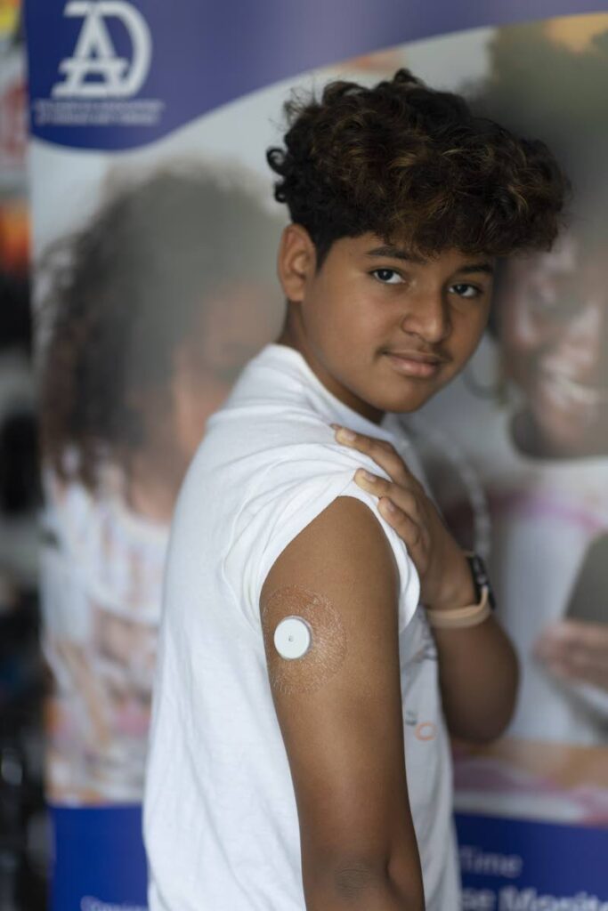 RideDatt Zion: Teenaged cyclist Zion Jennings, 14, shows his CGM arm implant, which helps him to manage his Type 1 Diabetes. The Diabetes Association of TT is raising funds to buy 150 CGMs for children with the condition. -  Photo courtesy TTGameplan/Dennis Tayé