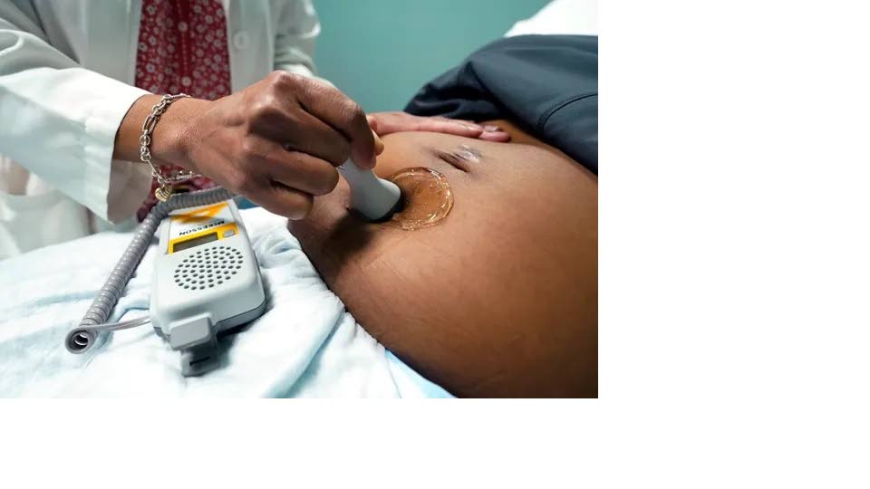 FILE: A doctor uses a hand-held Doppler probe on a pregnant woman to measure the heartbeat of a foetus. - AP Photo