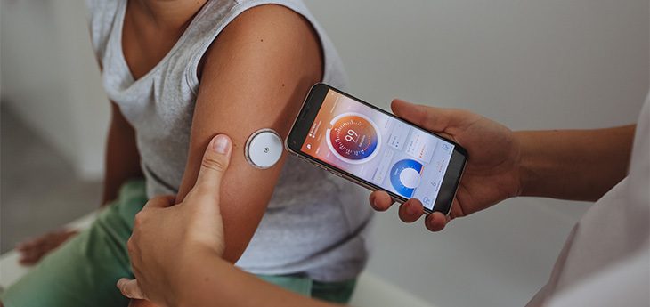 A continuous glucose monitor. - Photo courtesy UC Davis Health
